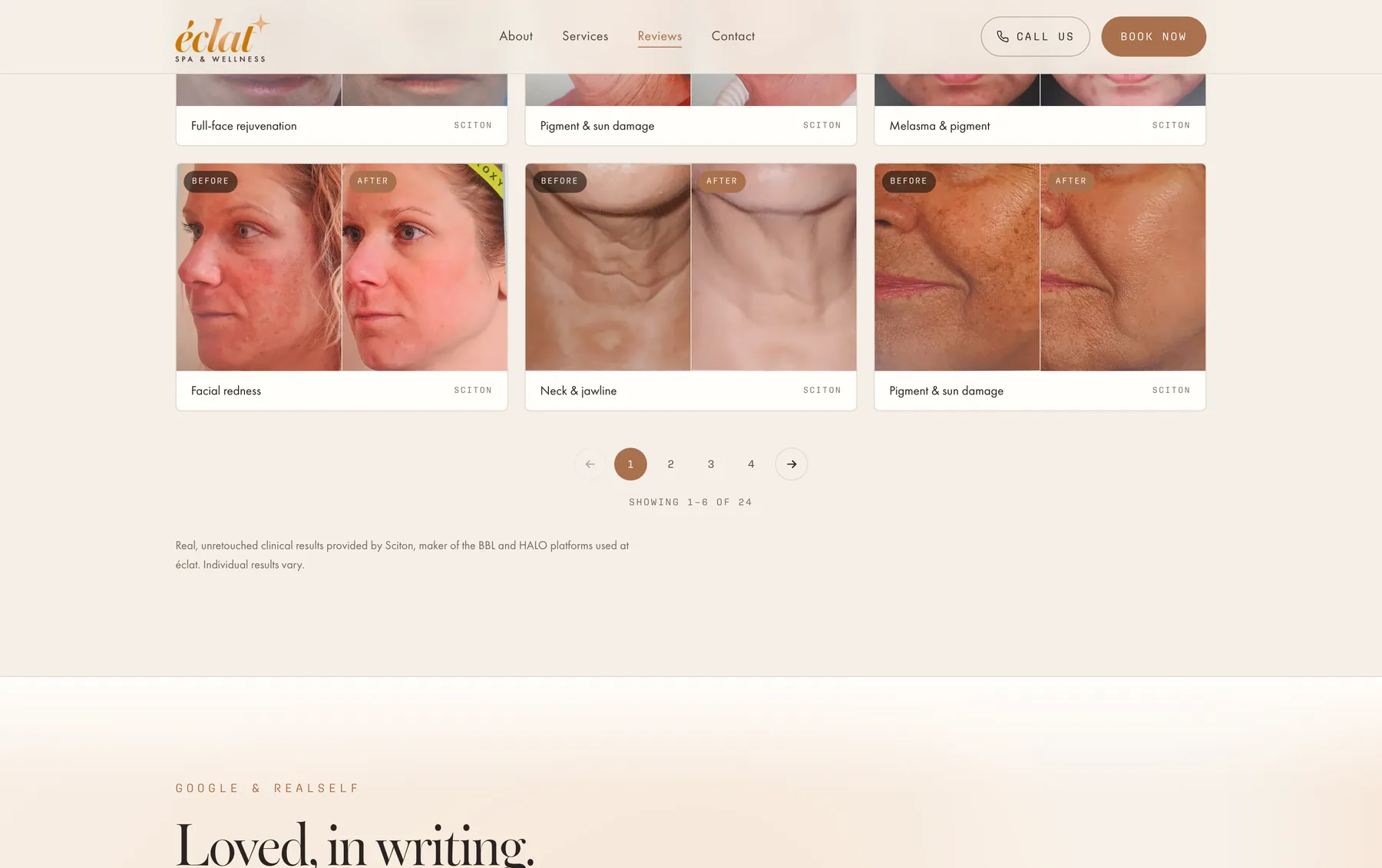 The Éclat reviews page, showing the before-and-after gallery laid out with both images visible side by side.